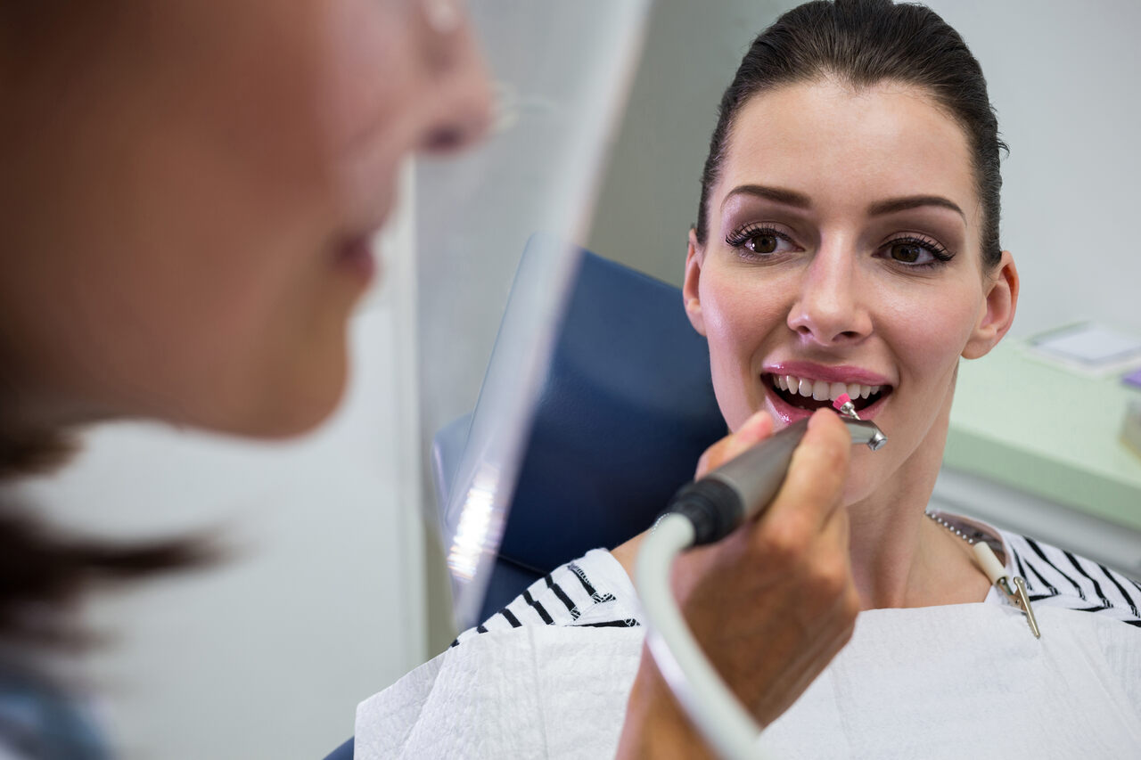 Zähne abschleifen für Veneers